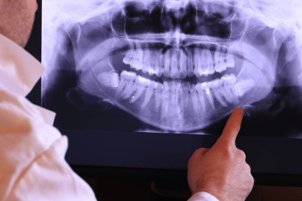 Best Emergency Cosmetic Dentistry (e.g., broken veneers) in Parsons, WV