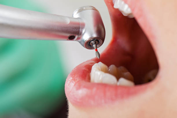 Best Broken or Chipped Tooth Repair in Parsons, WV